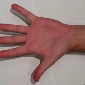 Anatomy Human Right Hand 3d model