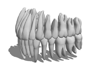 Anatomy Tooth Root Resorption 3d model