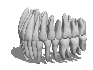 Anatomy Tooth Root Resorption 3d model Anatomy Tooth Root Resorption 3d model